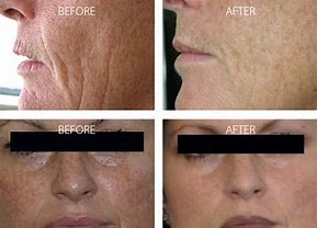 OM_BEFORE_AFTER_MAN